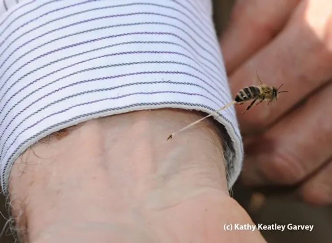 Close-up of a bee sting. This photo was taken when a guard bee was defending her colony. Note the stinger embedded in the arm and the stretched abdominal tissue as the bee pulls away. (Photo by Kathy Keatley Garvey)