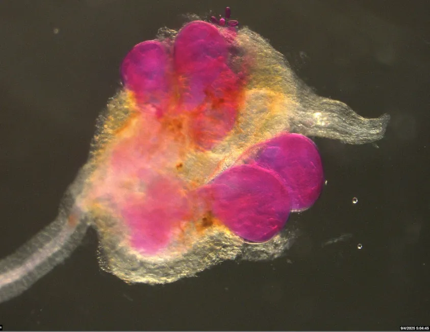 Female nematodes infecting bean roots. (Image by Pallavi Shakya)